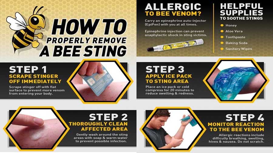 Infographic on the treatment of bee stings