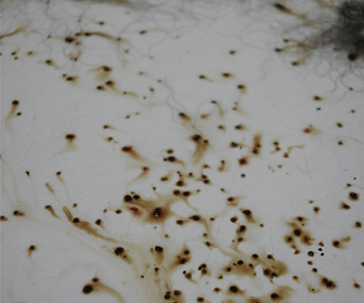 Picture of flea dirt that you might find on a bed