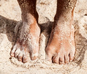 Image of a mans feet in the sand