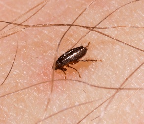 Picture of a flea on a person